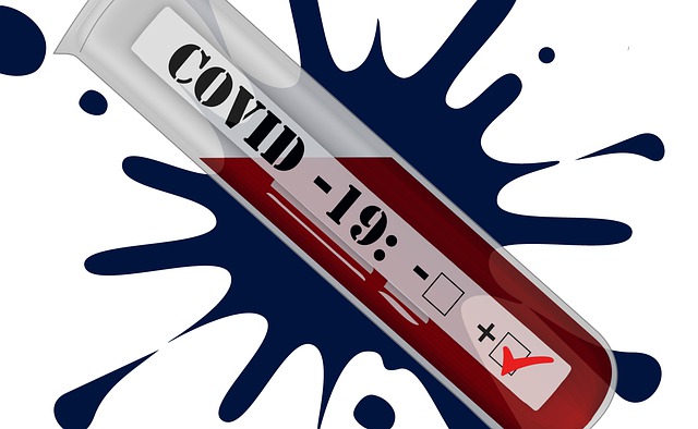 Prueba coronavirus-Covid19