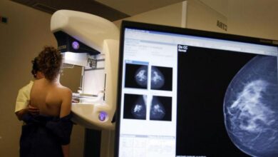 Científicos españoles crean un fármaco que frena la metástasis en cáncer de mama