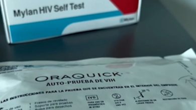 Costa Rica registra 763 autopruebas de VIH en lo que llevamos del 2025