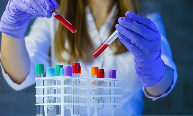 CCSS refuerza medidas de bioseguridad en hospitales ante detección de casos por bacteria Ralstonia