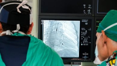 San Juan de Dios usa por primera vez dispositivo que salva función cardíaca