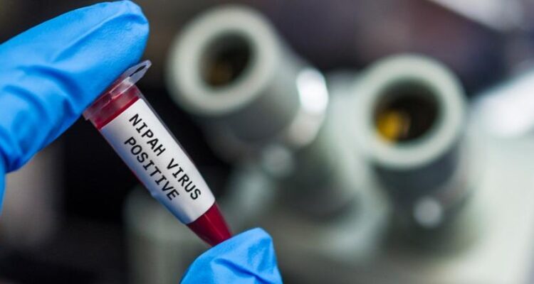 Ministerio de Salud dice que no existe alerta internacional por el virus Nipah