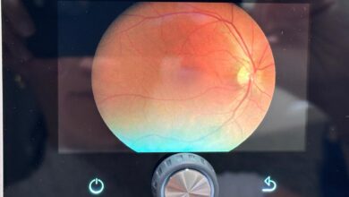 250 mil personas ganan acceso a salud visual mejorada en Limón