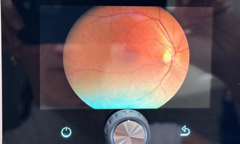 250 mil personas ganan acceso a salud visual mejorada en Limón