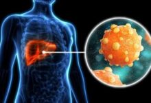 CCSS alerta por aumento de casos de hepatitis A