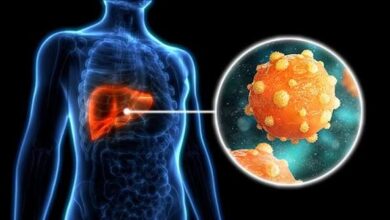 CCSS alerta por aumento de casos de hepatitis A